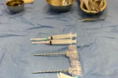 infiltraciones
